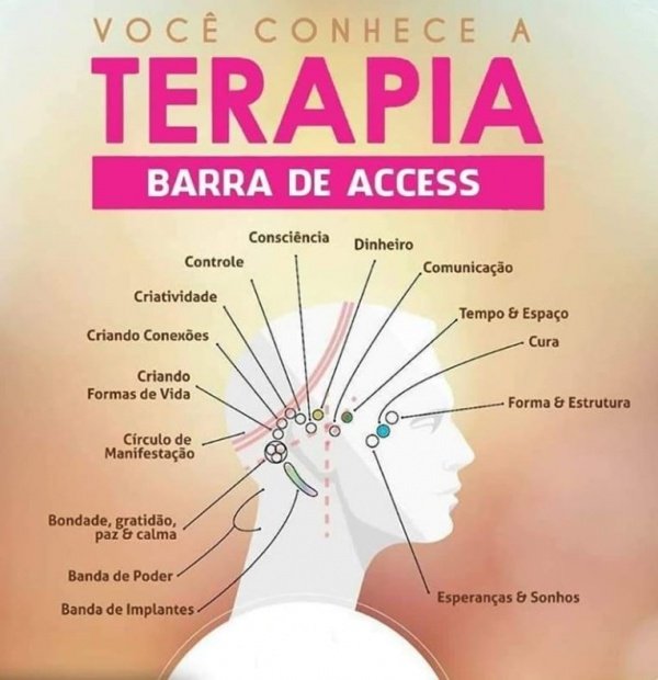 Barras de Access